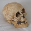 3. ID COR2_012_004 Skull dug up in 1979 behind the Coast Road cottages near West Mersea church.
Cat1 Museum-->History Cat2 Museum-->Artefacts and Contents Cat3 Museum-->Artefacts and Contents